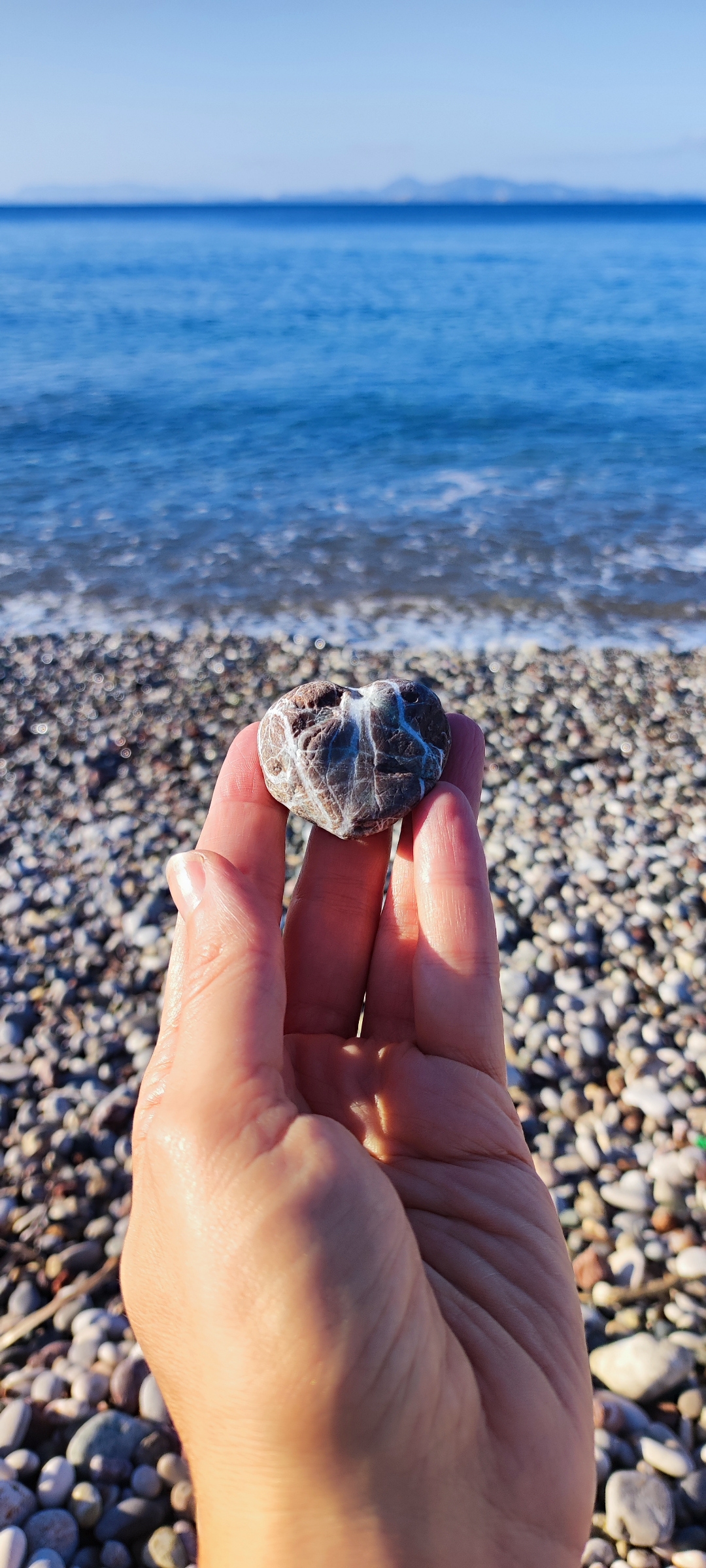 Endometriosis and invisible pain while living abroad Arianna Magnani